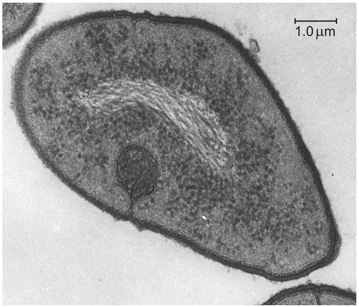 Figure for Question 1 — IB Biology HL