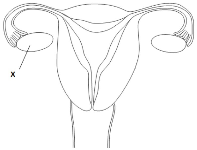 Figure for Question 1 — IB Biology HL