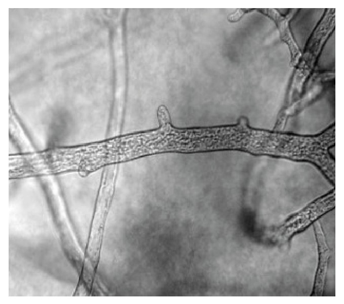 Aseptate fungal hyphae