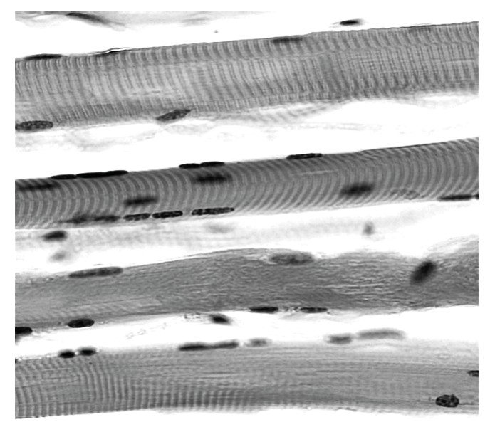Striated muscle fibres