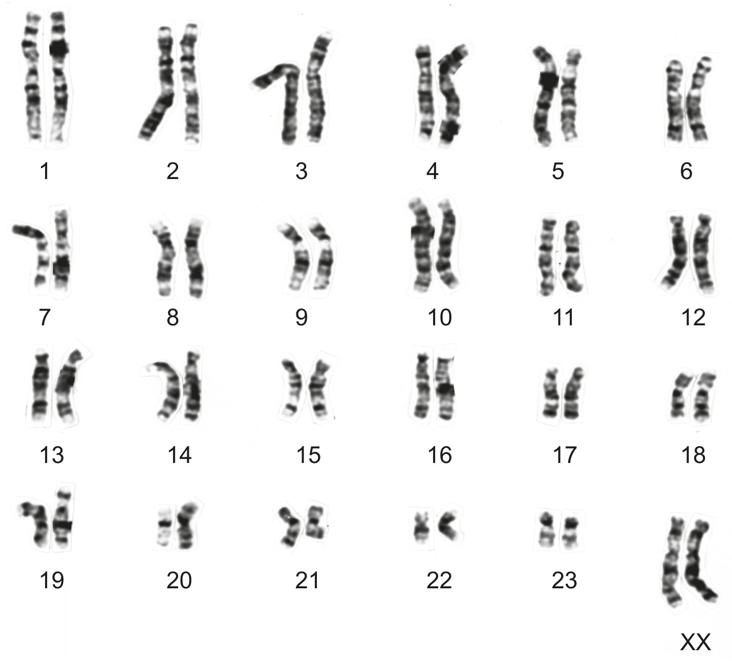 Table for Question 1 — IB Biology SL