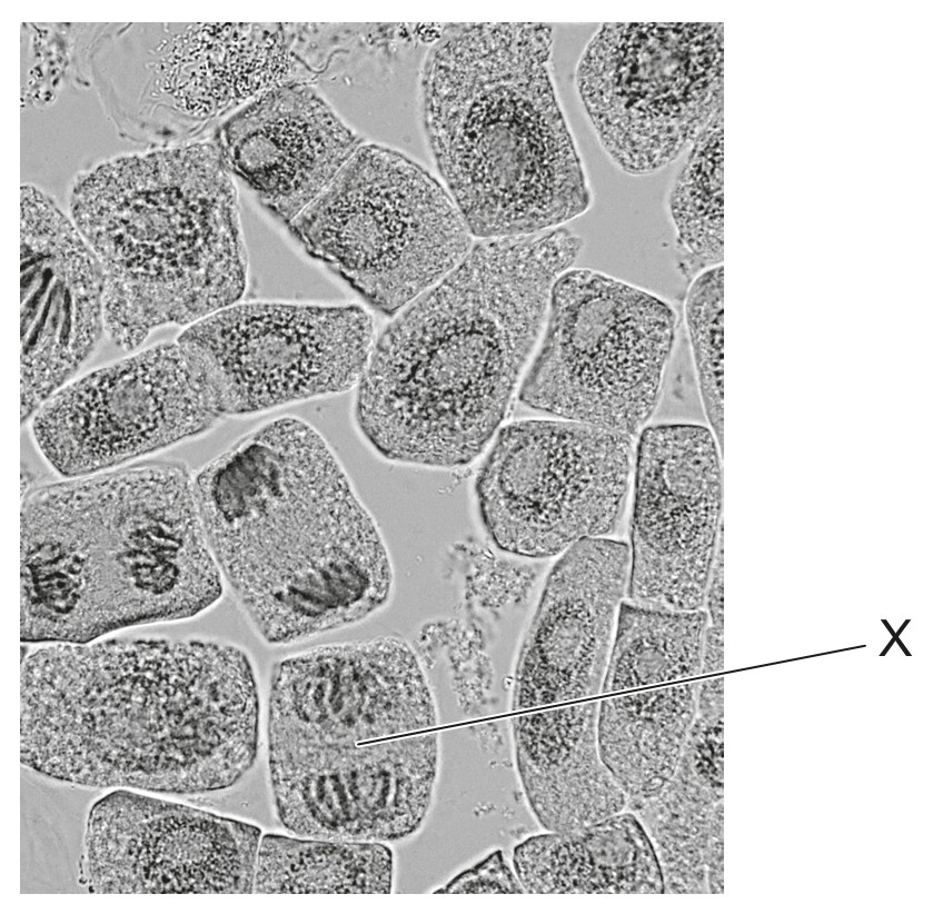 Figure for Question 1 — IB Biology HL