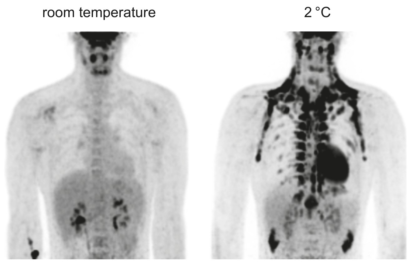 Figure for Question 1 — IB Biology HL