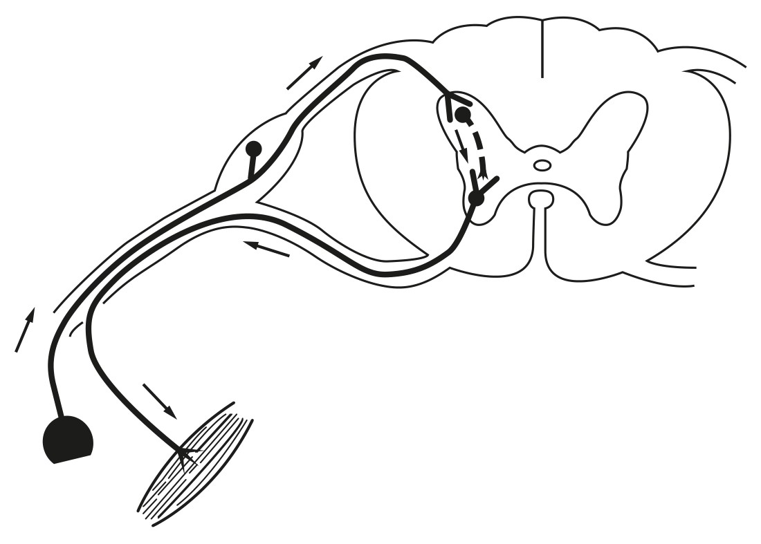 Figure for Question (a) — IB Biology HL