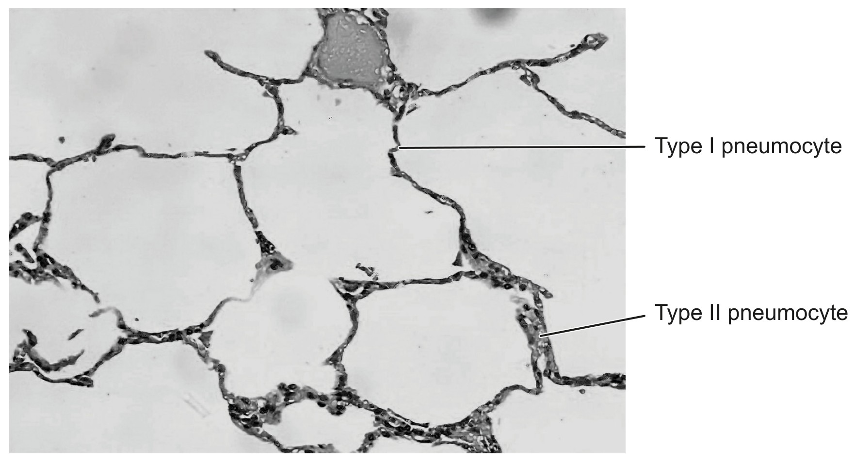 Figure for Question 1 — IB Biology HL