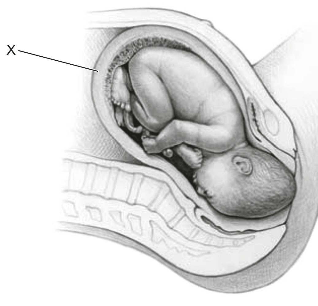 Figure for Question 1 — IB Biology HL