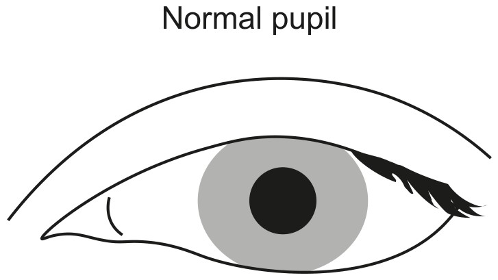 Figure for Question 1 — IB Biology HL