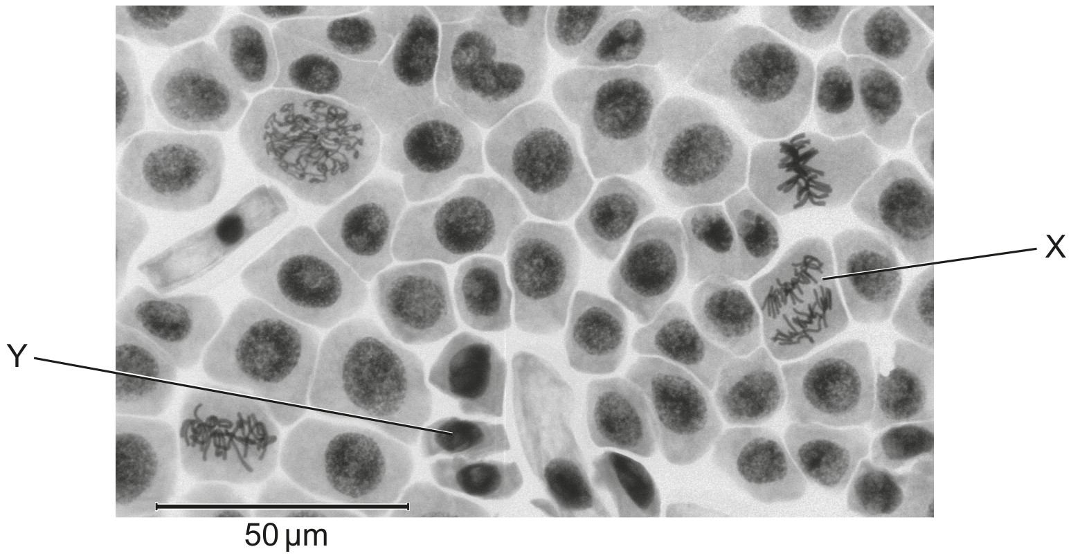 Figure for Question 1 — IB Biology HL