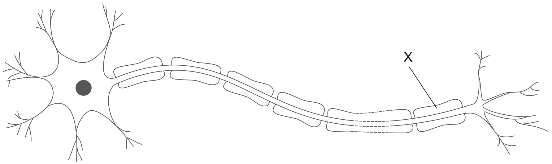Figure for Question 1 — IB Biology HL