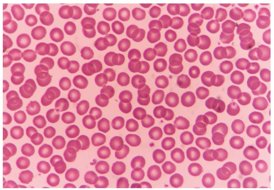 Figure for Question 1 — IB Biology HL